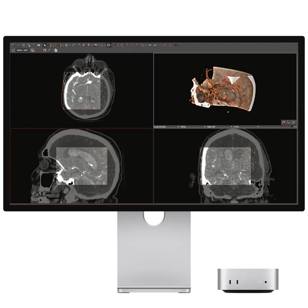 Apple Studio Display XDR - Afbeelding 3
